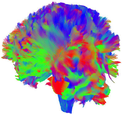 Full brain tractography